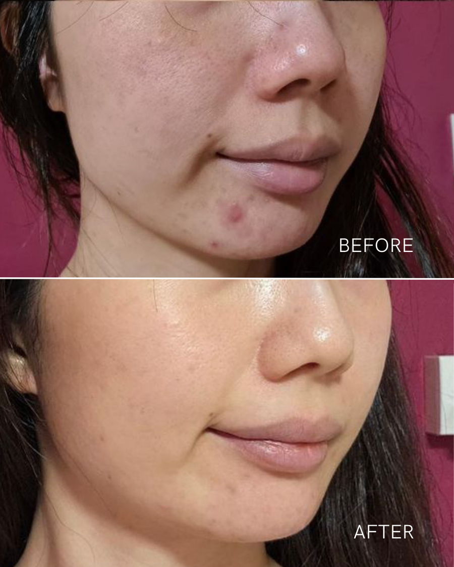 Customer result